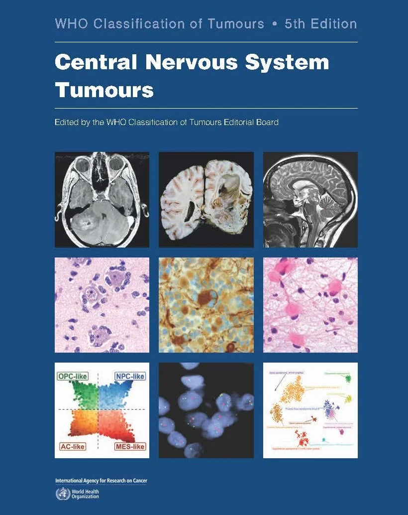 Central Nervous System Tumours: Who Classification of Tumours