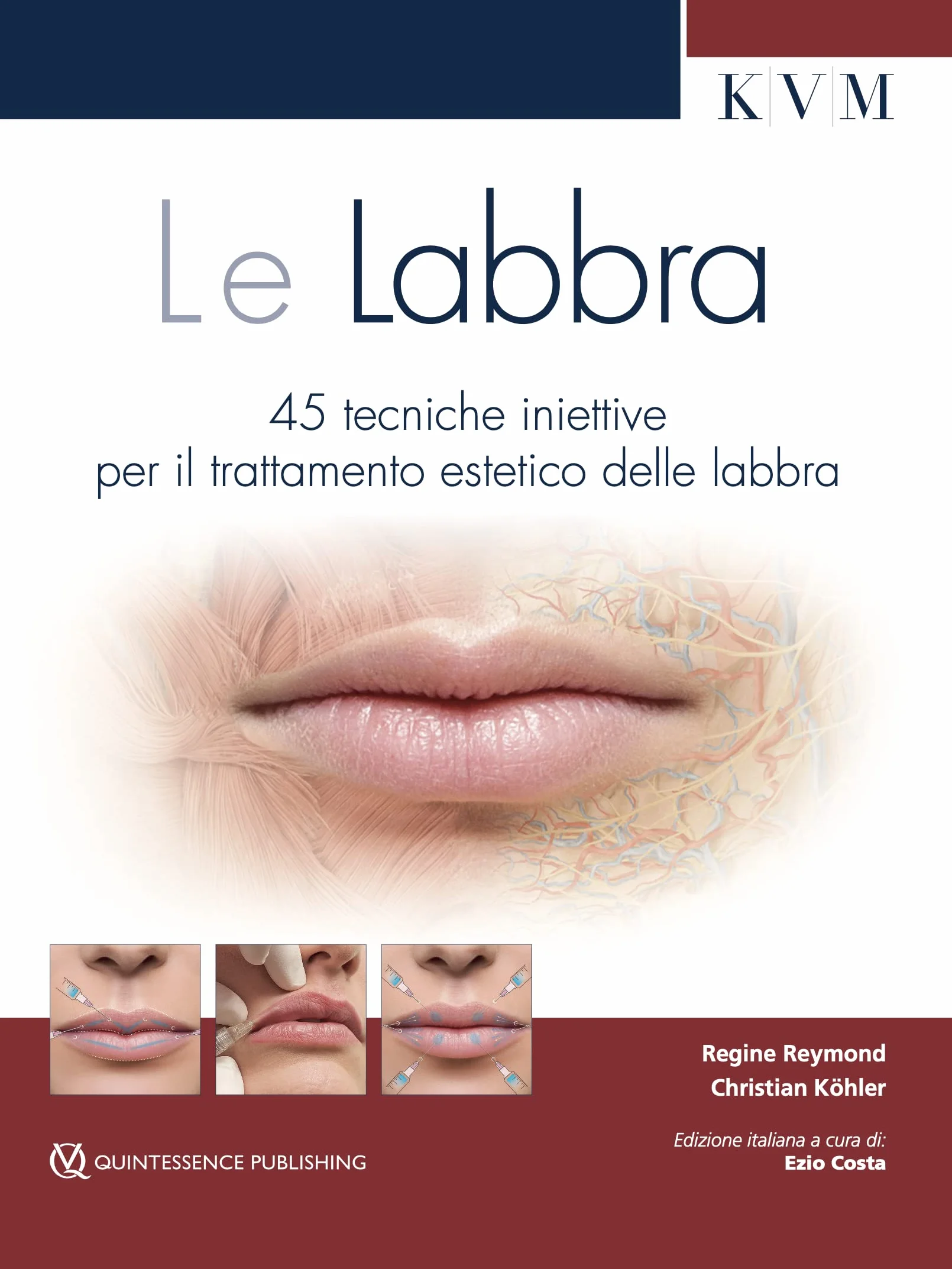 Le labbra. 45 tecniche iniettive per il trattamento estetico delle labbra