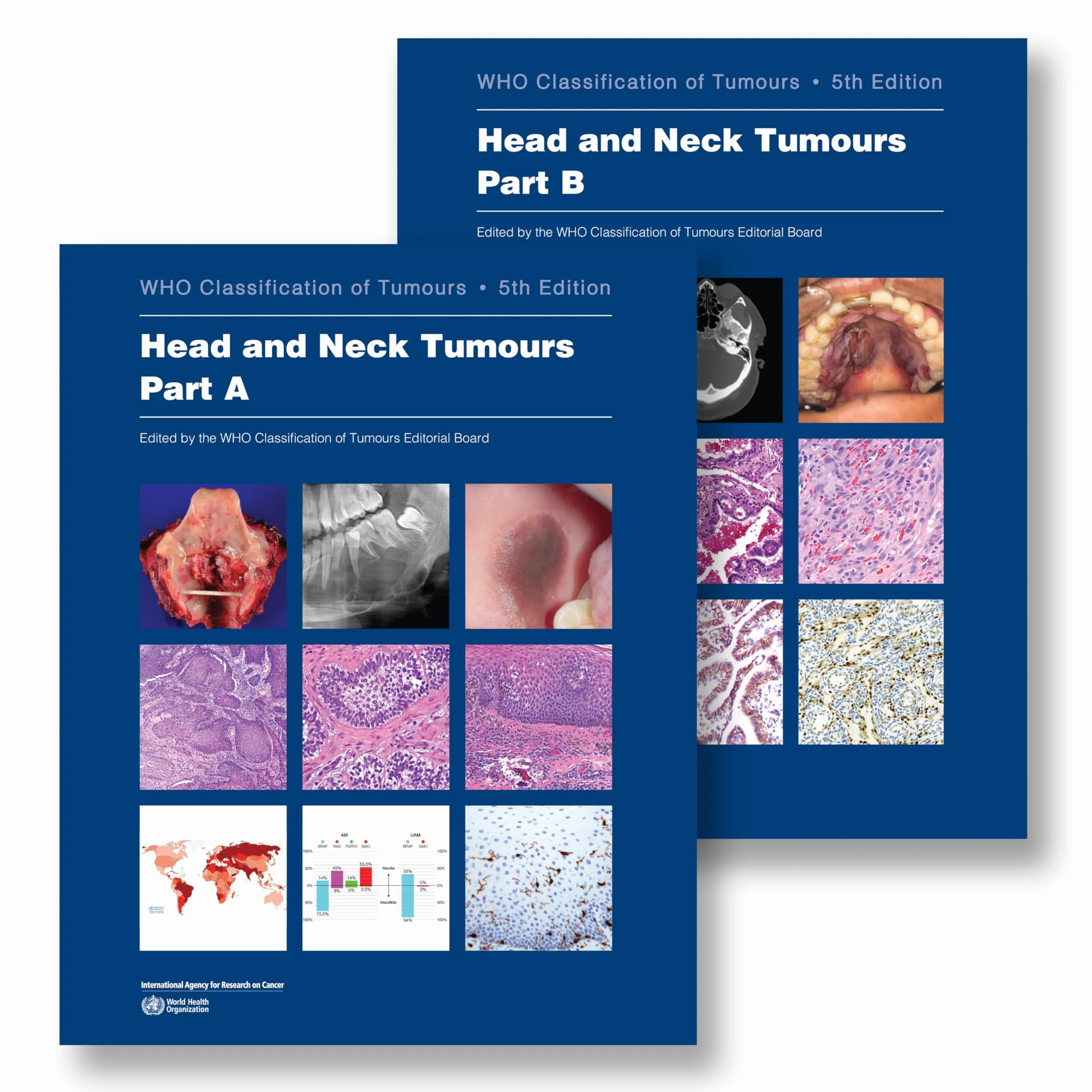 Head and Neck Tumours