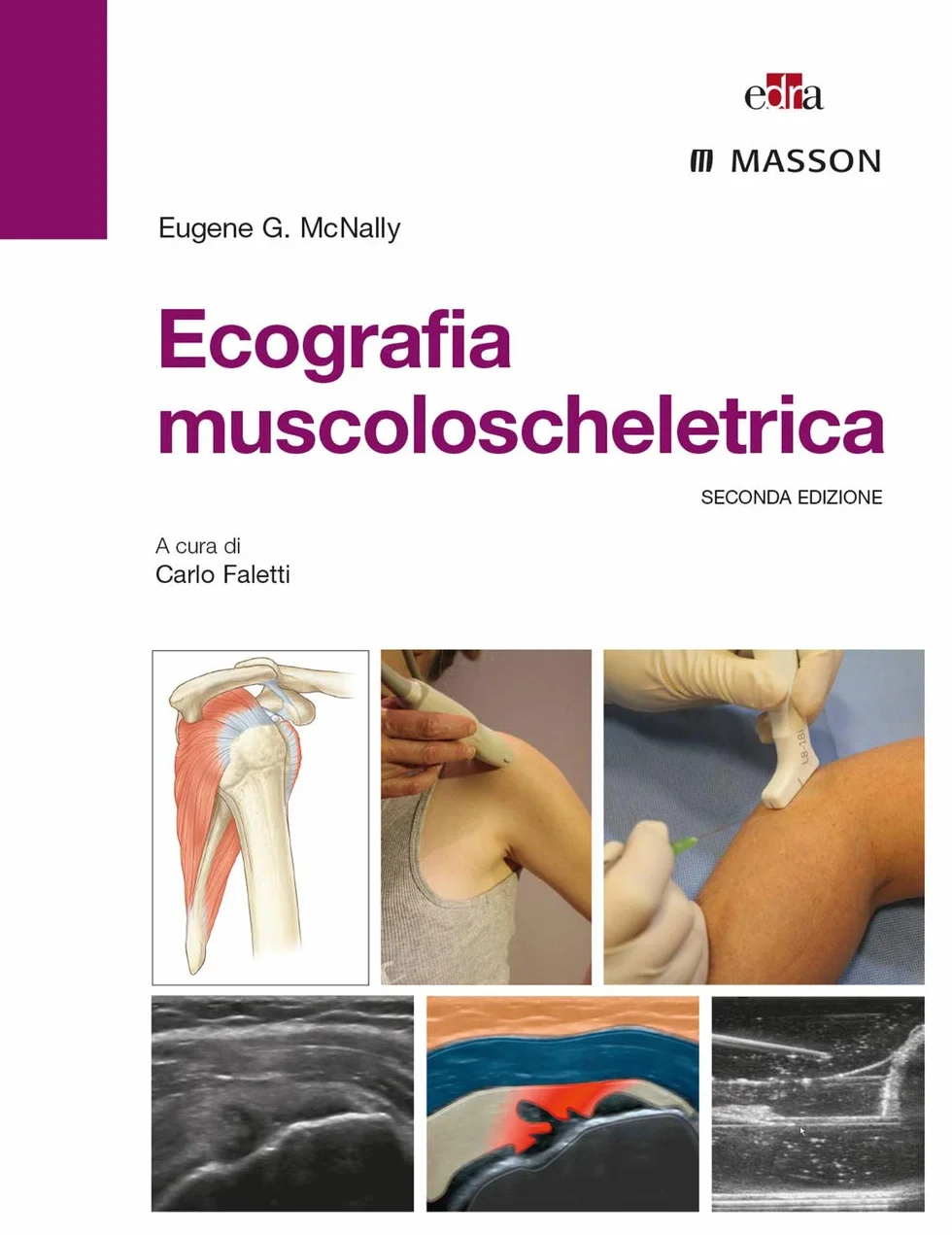 Ecografia muscoloscheletrica. Ediz. illustrata