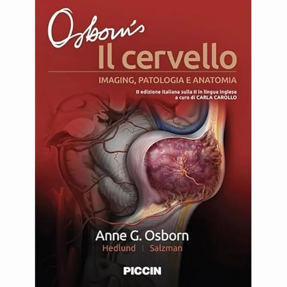 Il cervello. Imaging, patologia e anatomia