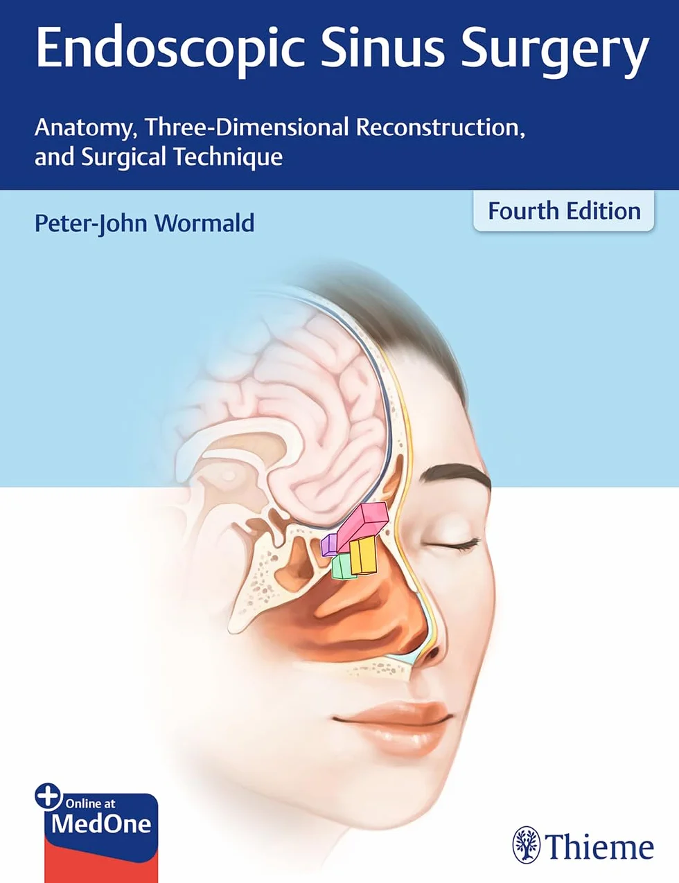 Endoscopic Sinus Surgery: Anatomy, Three-Dimensional Reconstruction, and Surgical Technique [Lingua inglese]