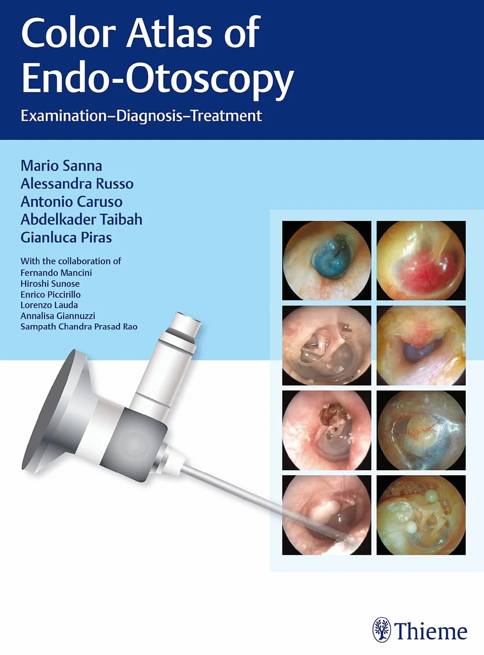 Color Atlas of Endo-Otoscopy: Examination-Diagnosis-Treatment [Lingua inglese]