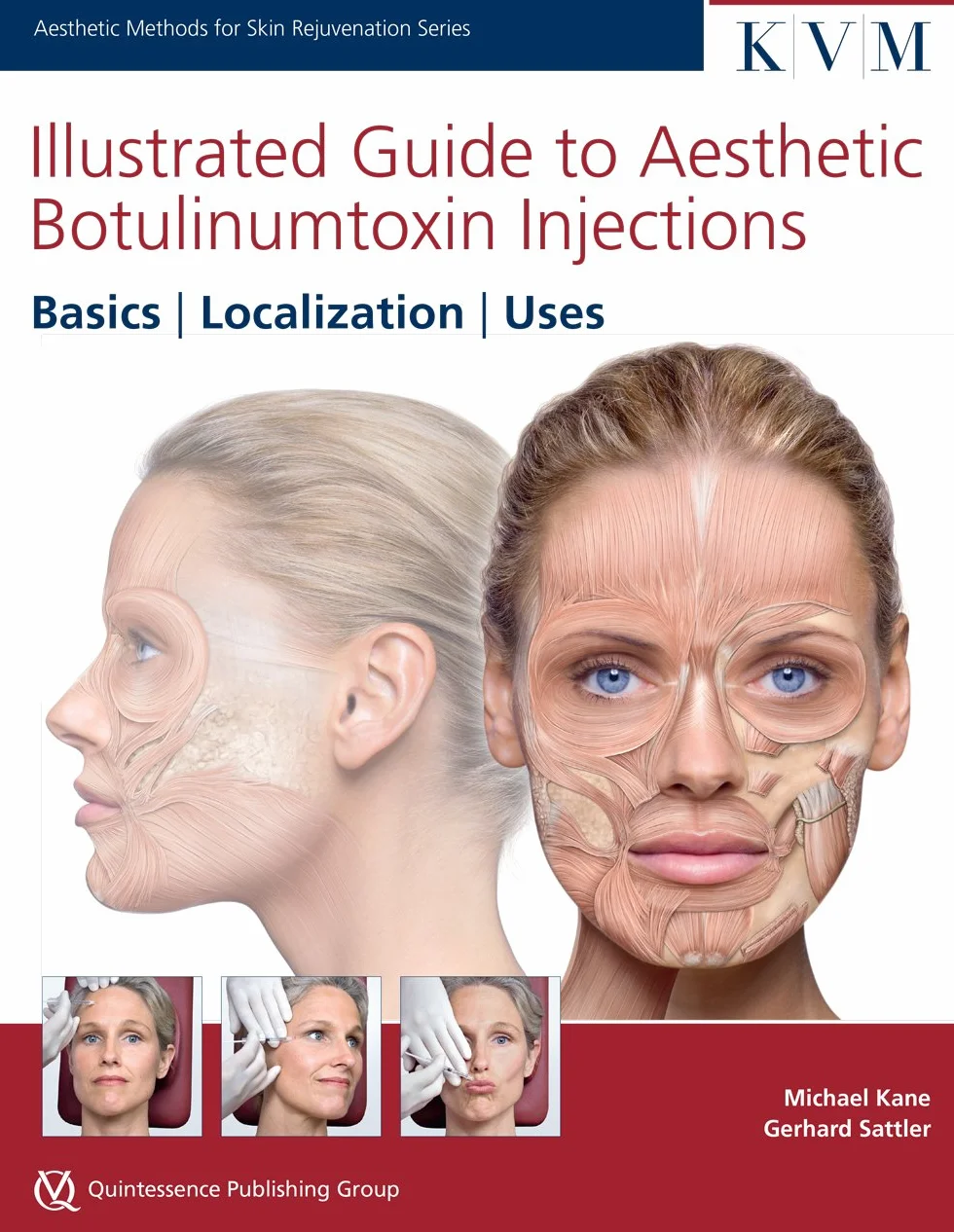 Illustrated Guide to Aesthetic Botulinum Toxin Injections: Basics / Localization / Uses