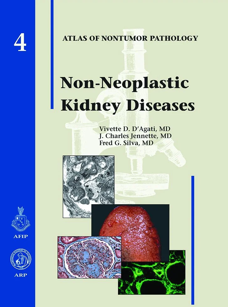 Non-neoplastic Kidney Diseases: No 4