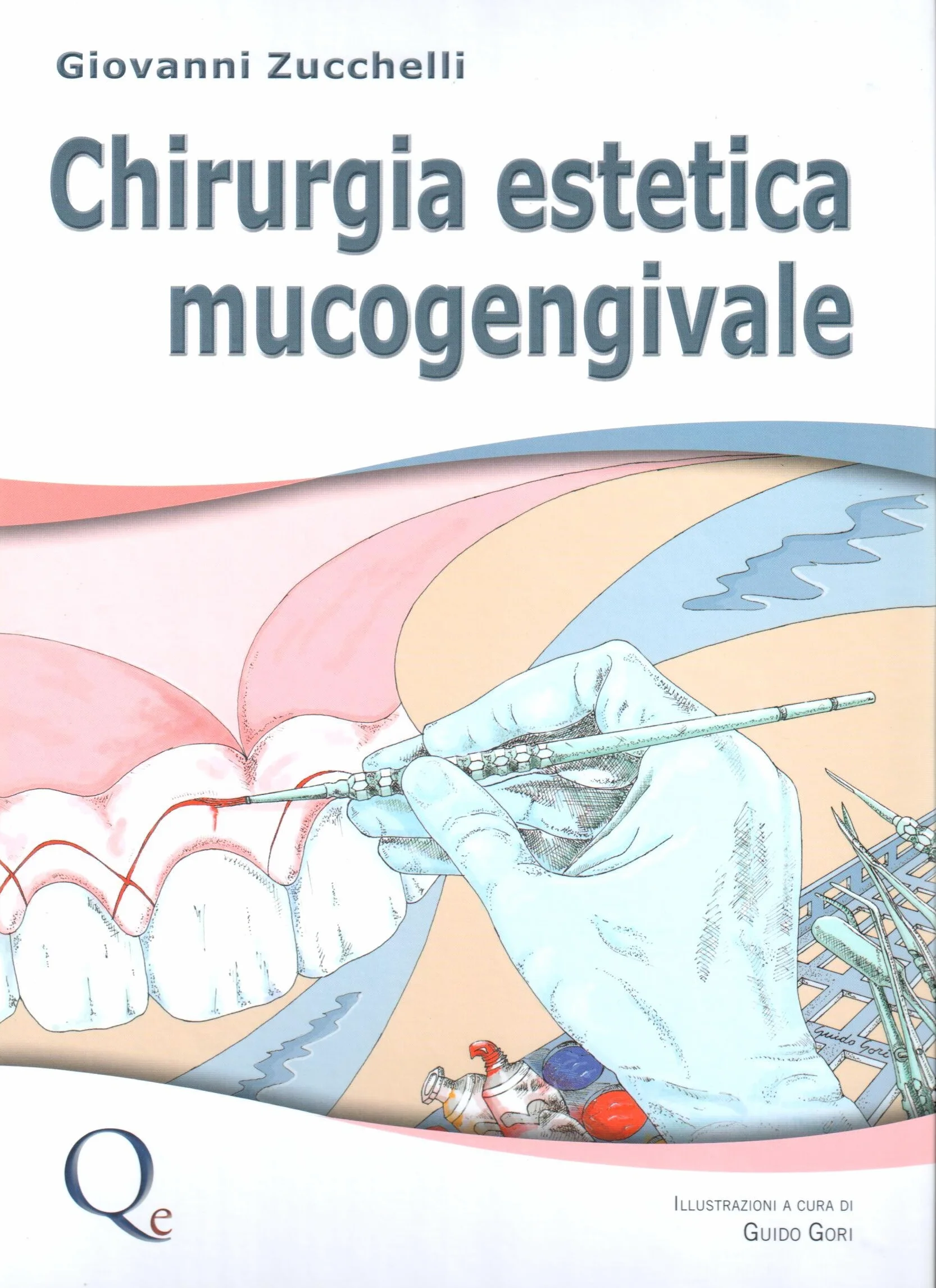 Chirurgia estetica mucogengivale