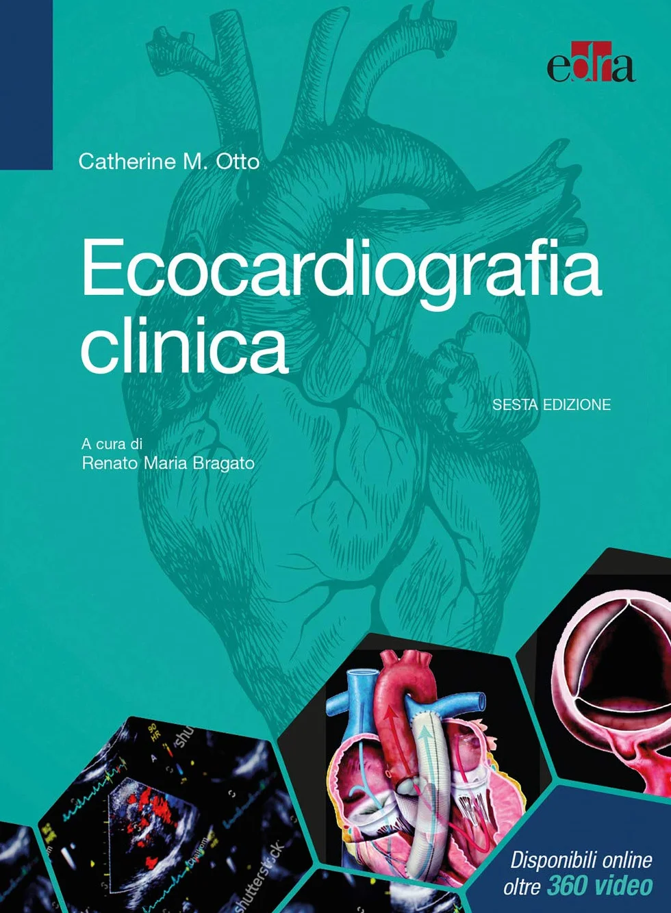 Ecocardiografia clinica