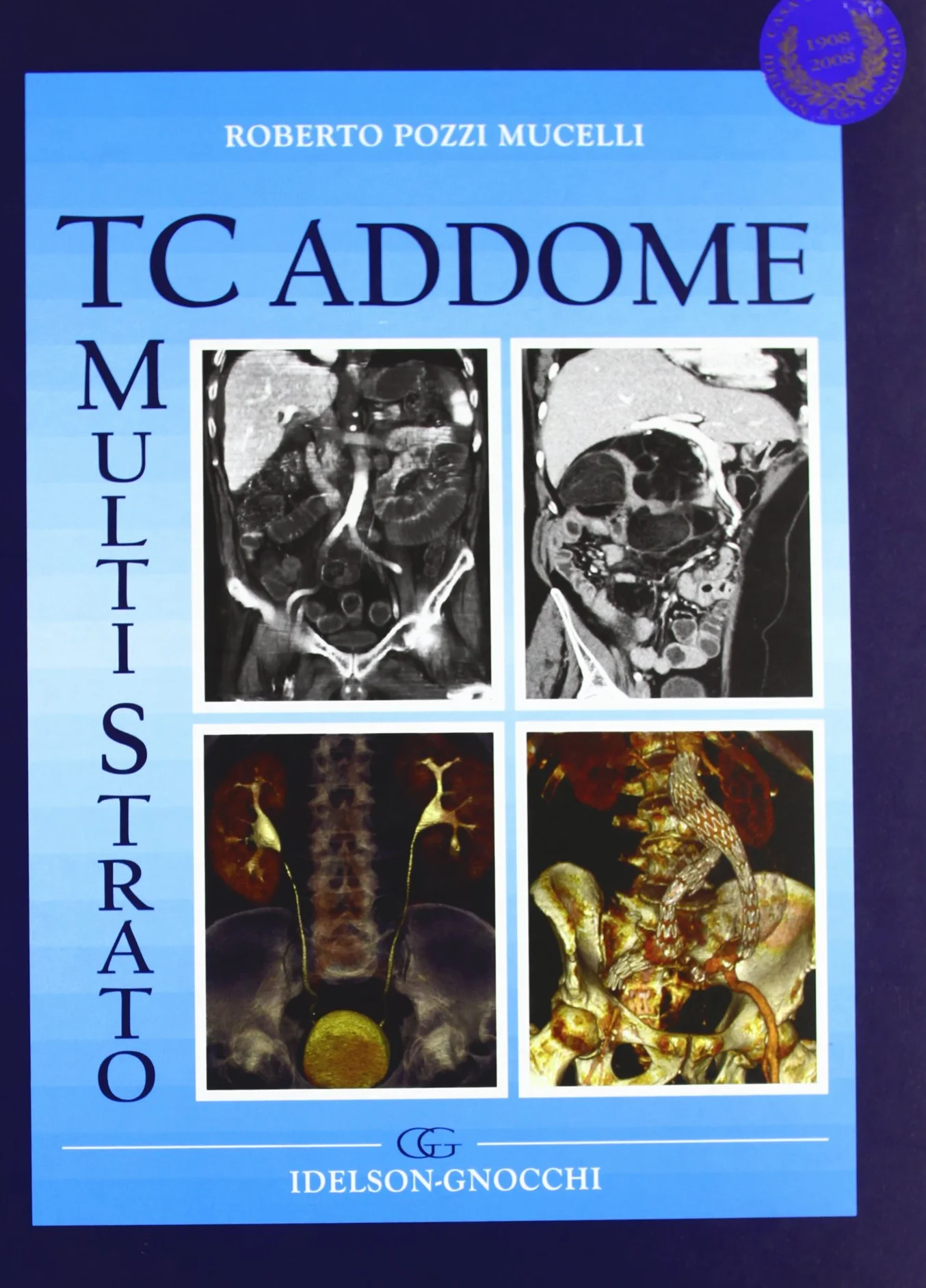 TC multistrato dell'addome