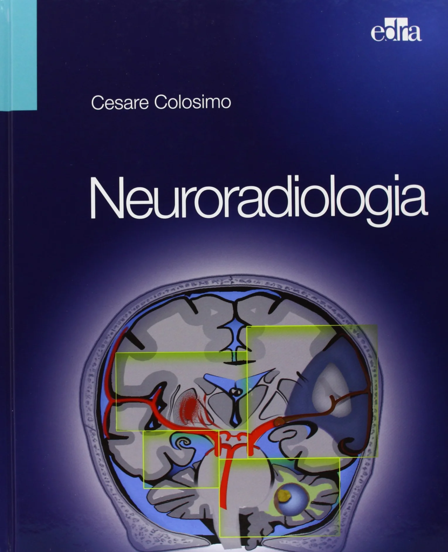Neuroradiologia