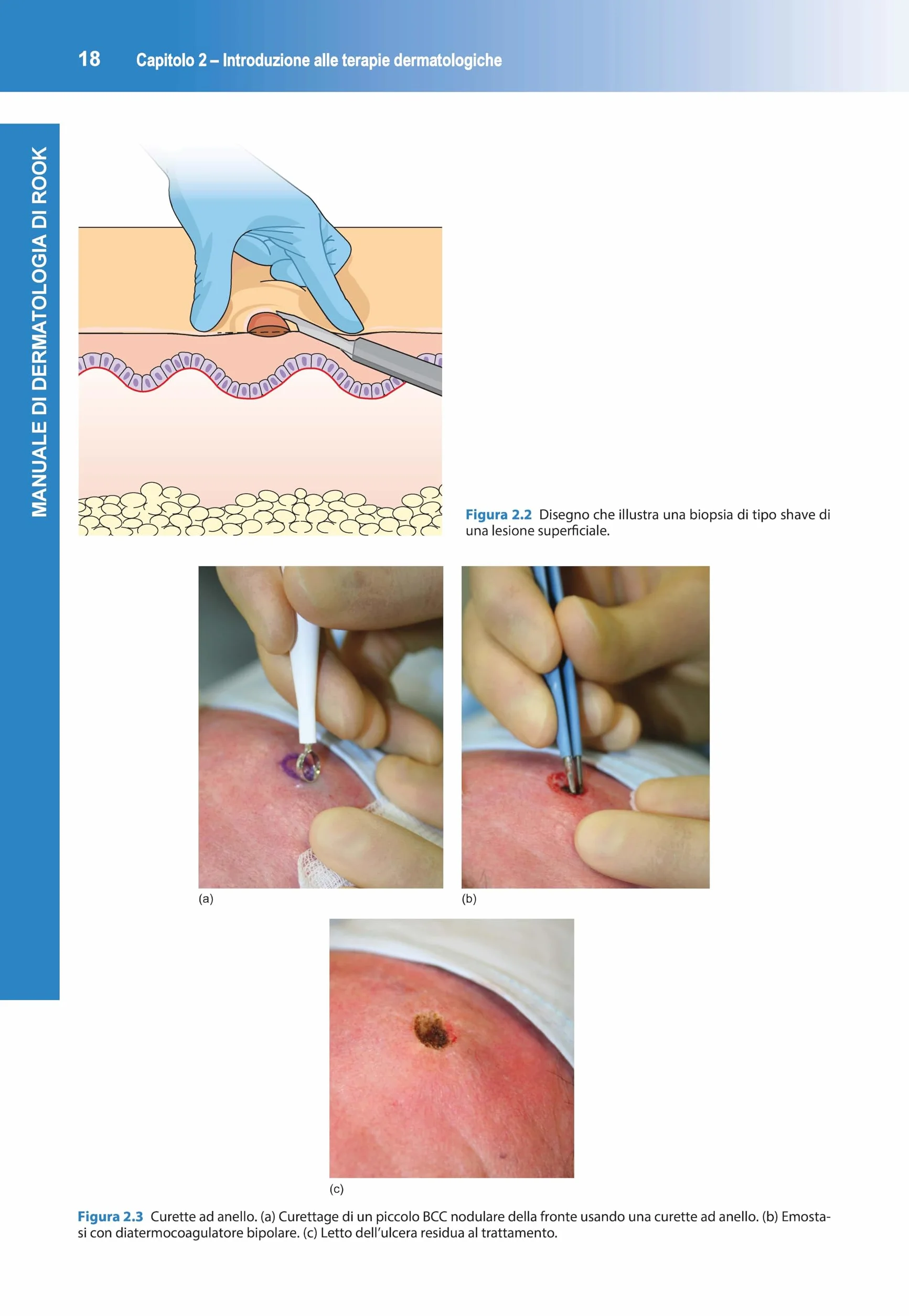 Manuale di dermatologia di Rook