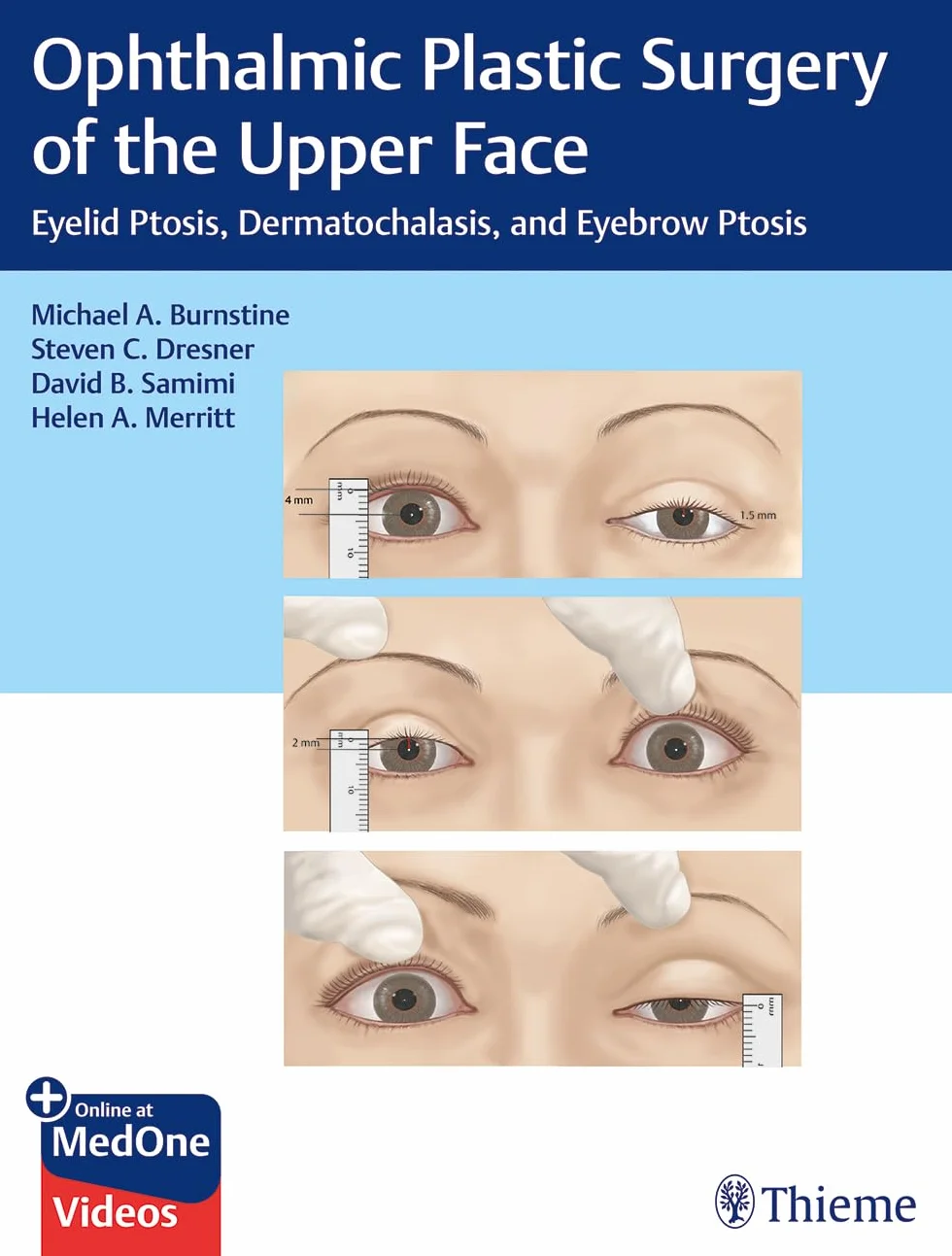 Ophthalmic Plastic Surgery of the Upper Face: Eyelid Ptosis, Dermatochalasis, and Eyebrow Ptosis