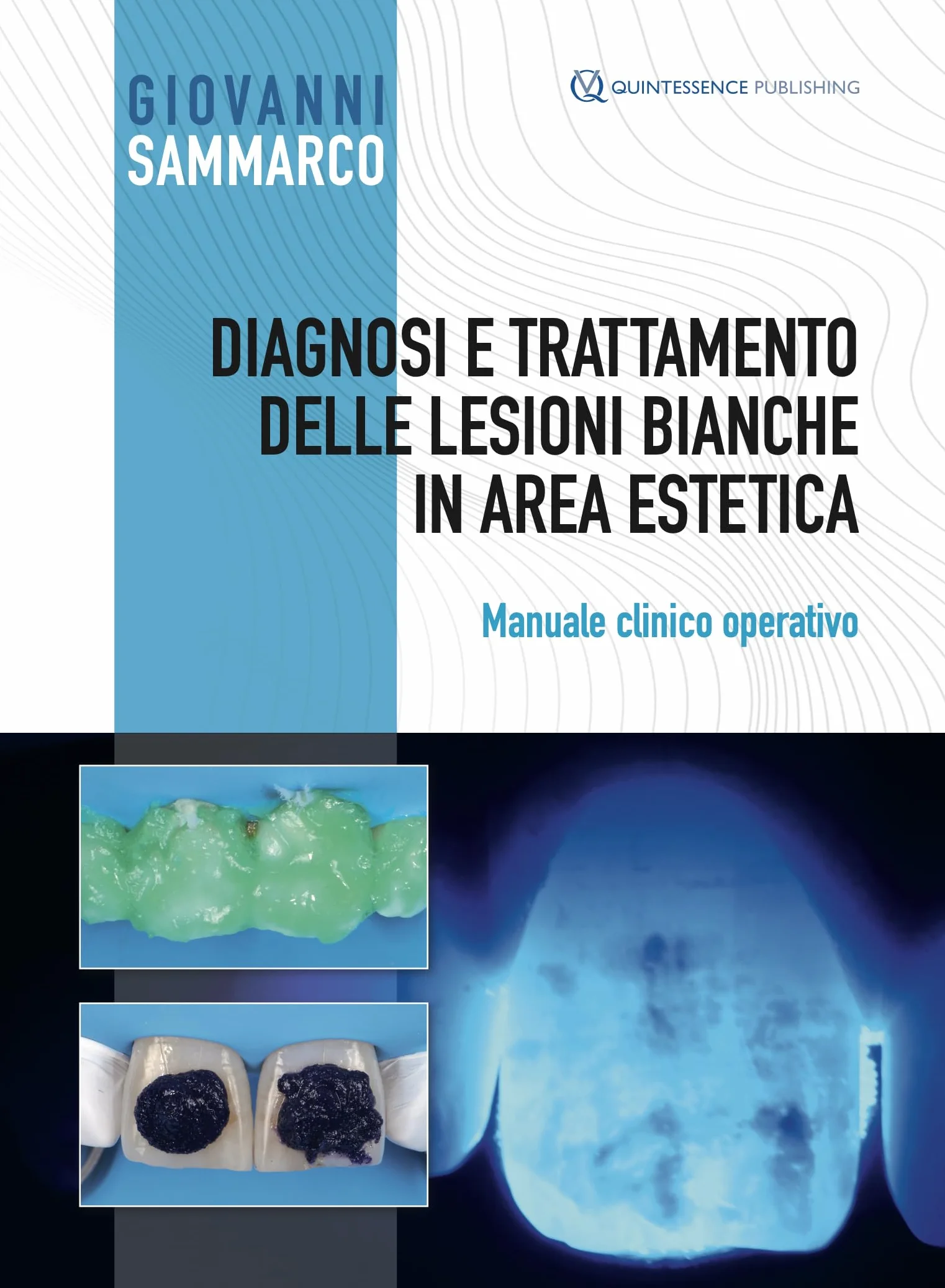 Diagnosi e trattamento delle lesioni bianche in area estetica. Manuale clinico operativo