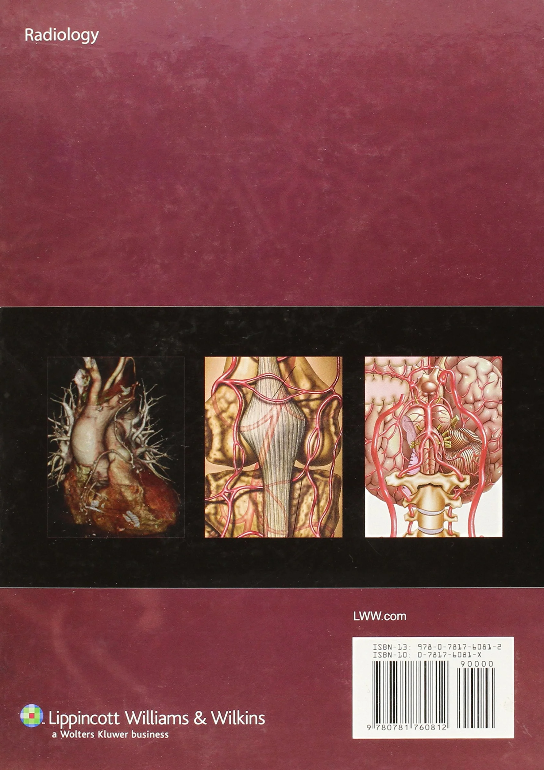 Atlas of Vascular Anatomy: An Angiographic Approach