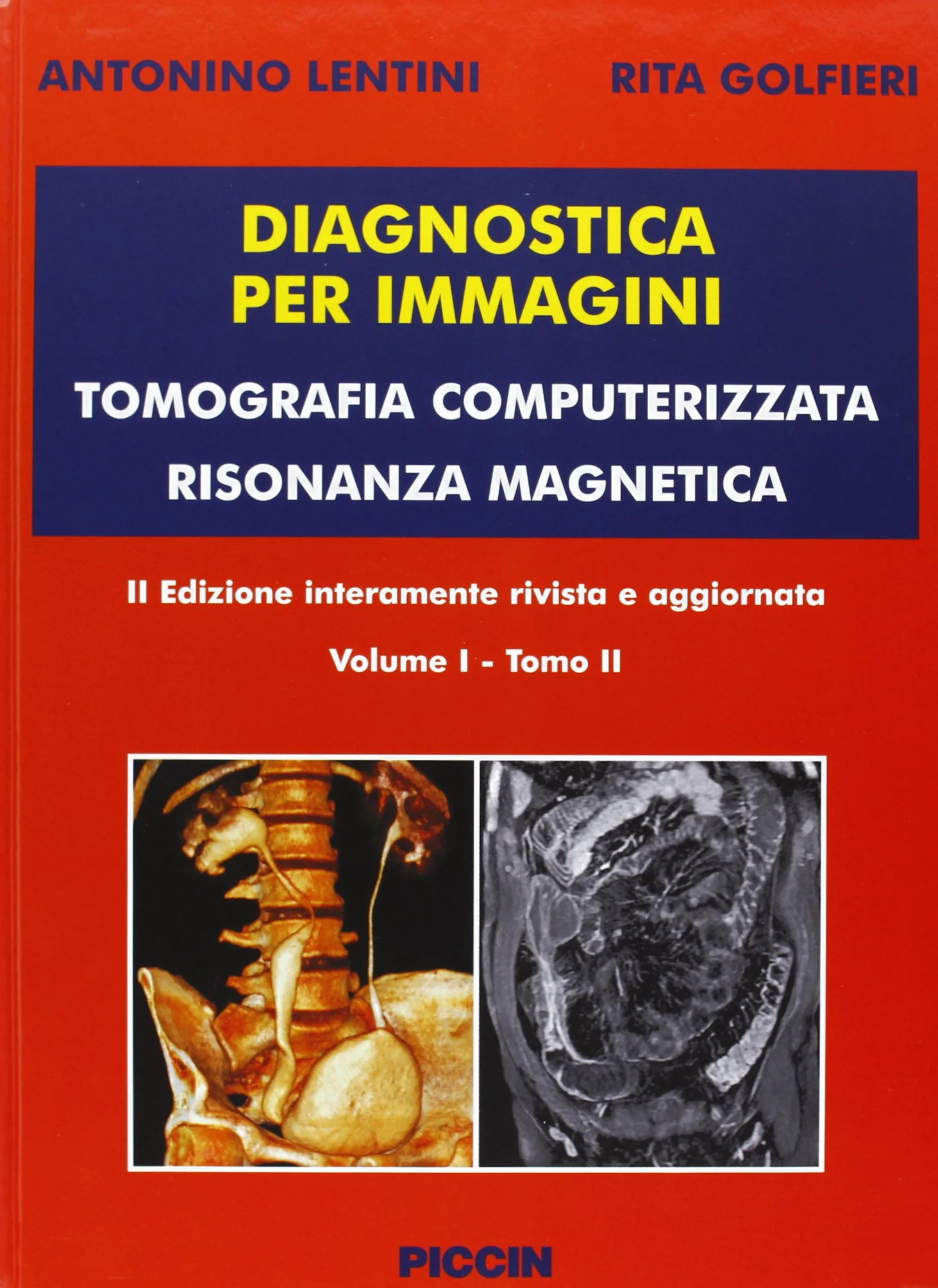 Diagnostica per immagini vol. 1/1 e 1/2. Tomografia computerizzata risonanza magnetica