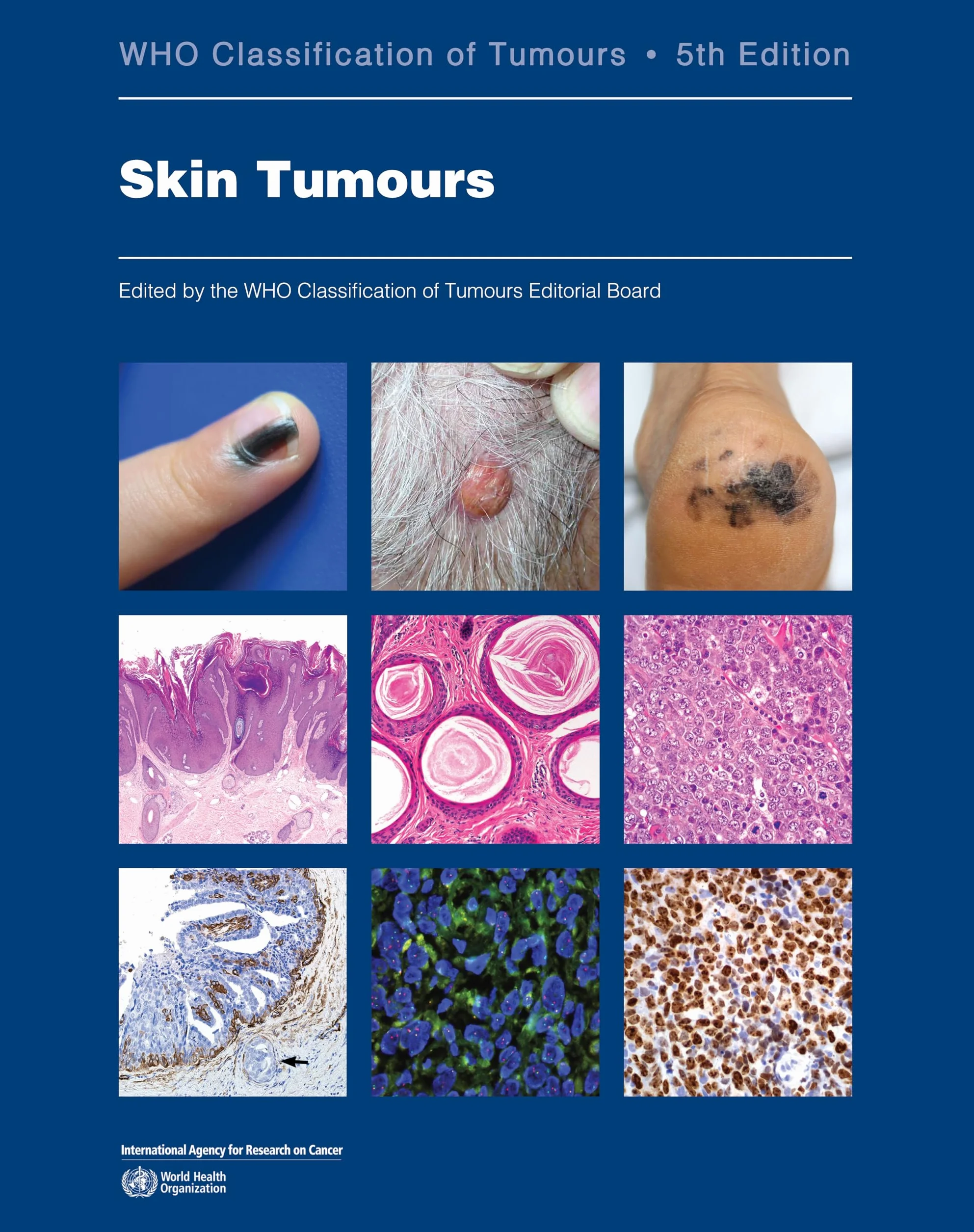 WHO Classification of Skin Tumours 5th edition