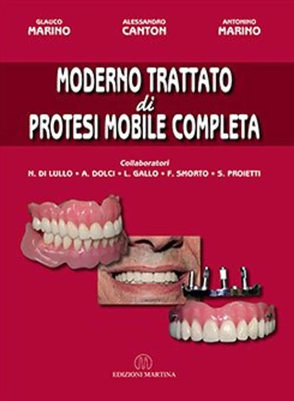 Moderno trattato di protesi mobile completa