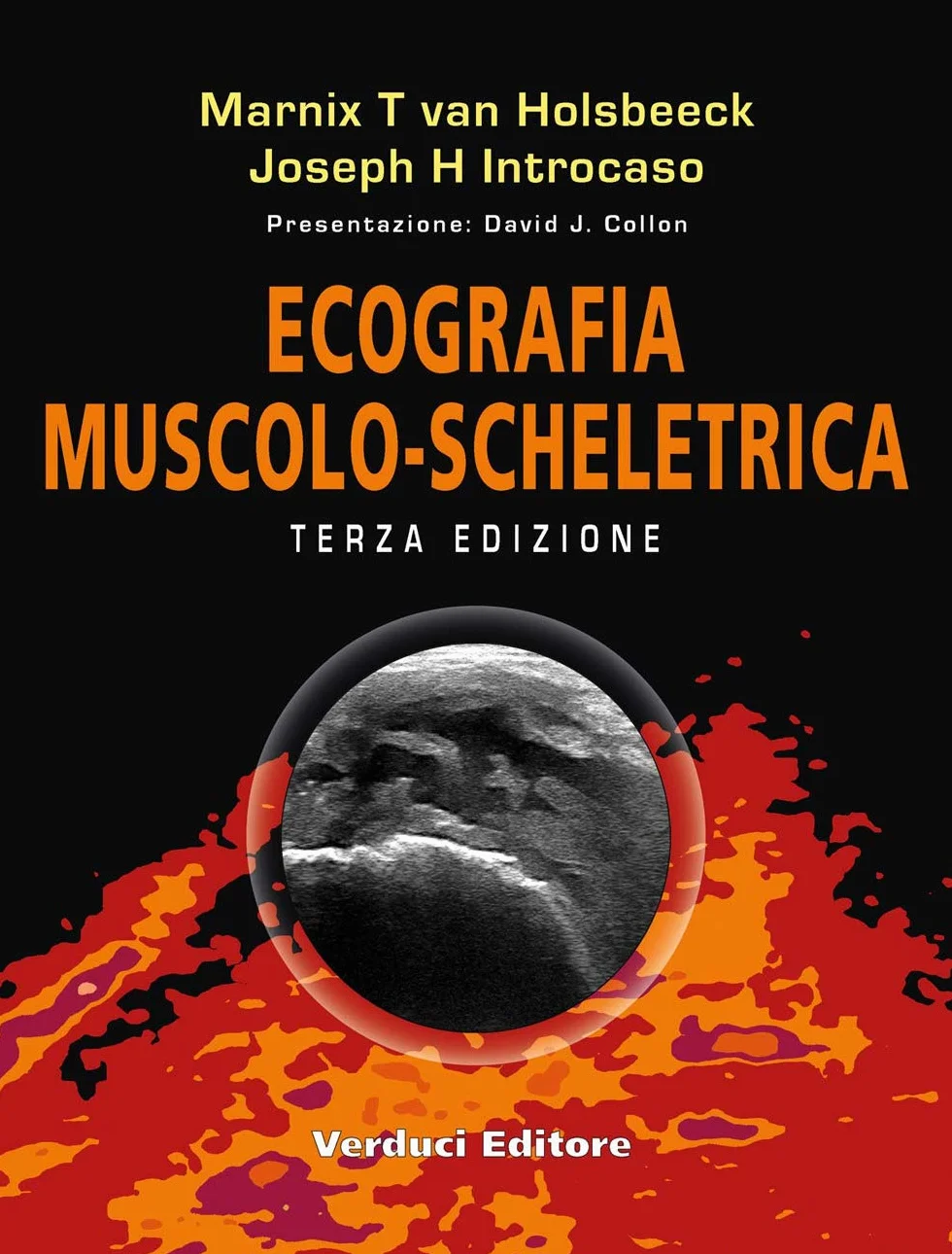 Ecografia muscolo-scheletrica