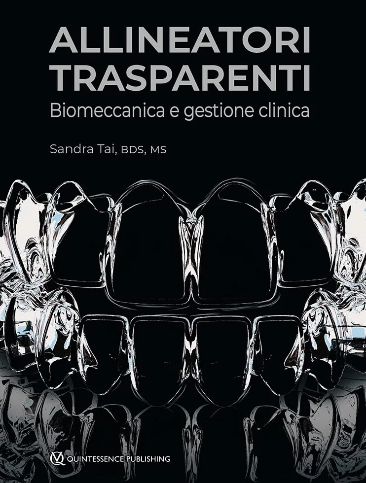Allineatori trasparenti. Biomeccanica e gestione clinica