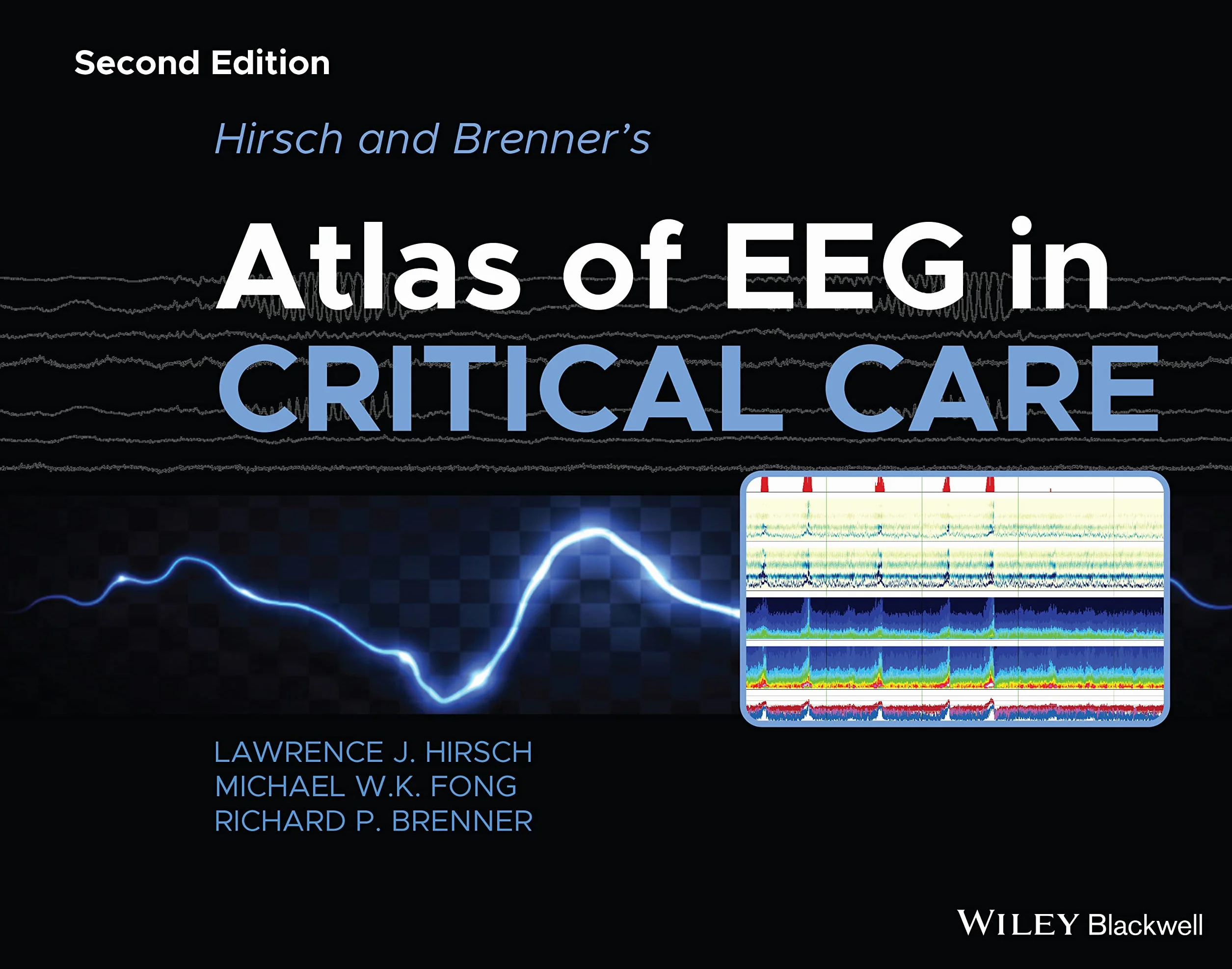 Hirsch and Brenner's Atlas of EEG in Critical Care