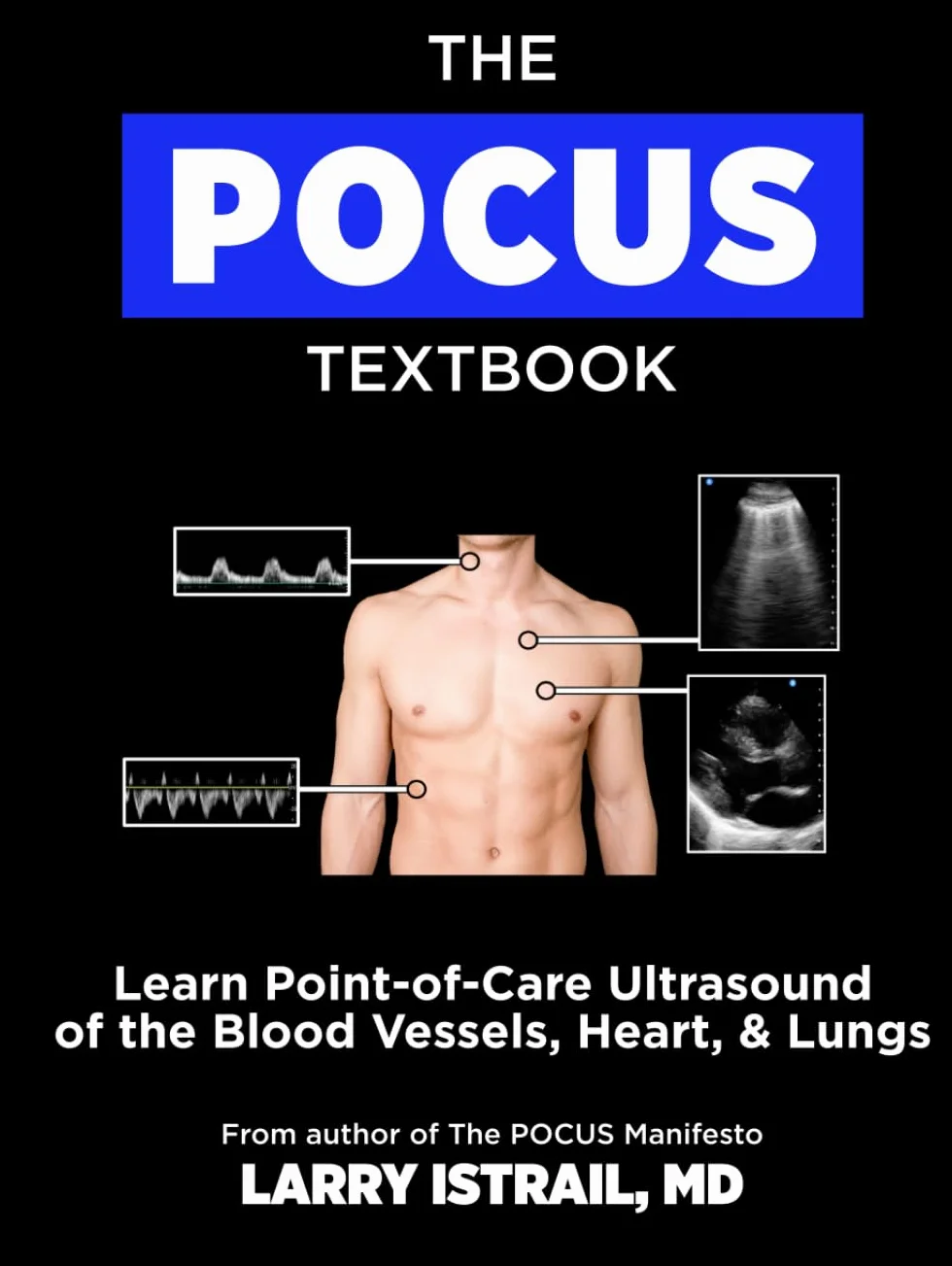 The POCUS Textbook: Learn Point-of-Care Ultrasound of the Blood Vessels, Heart, & Lungs