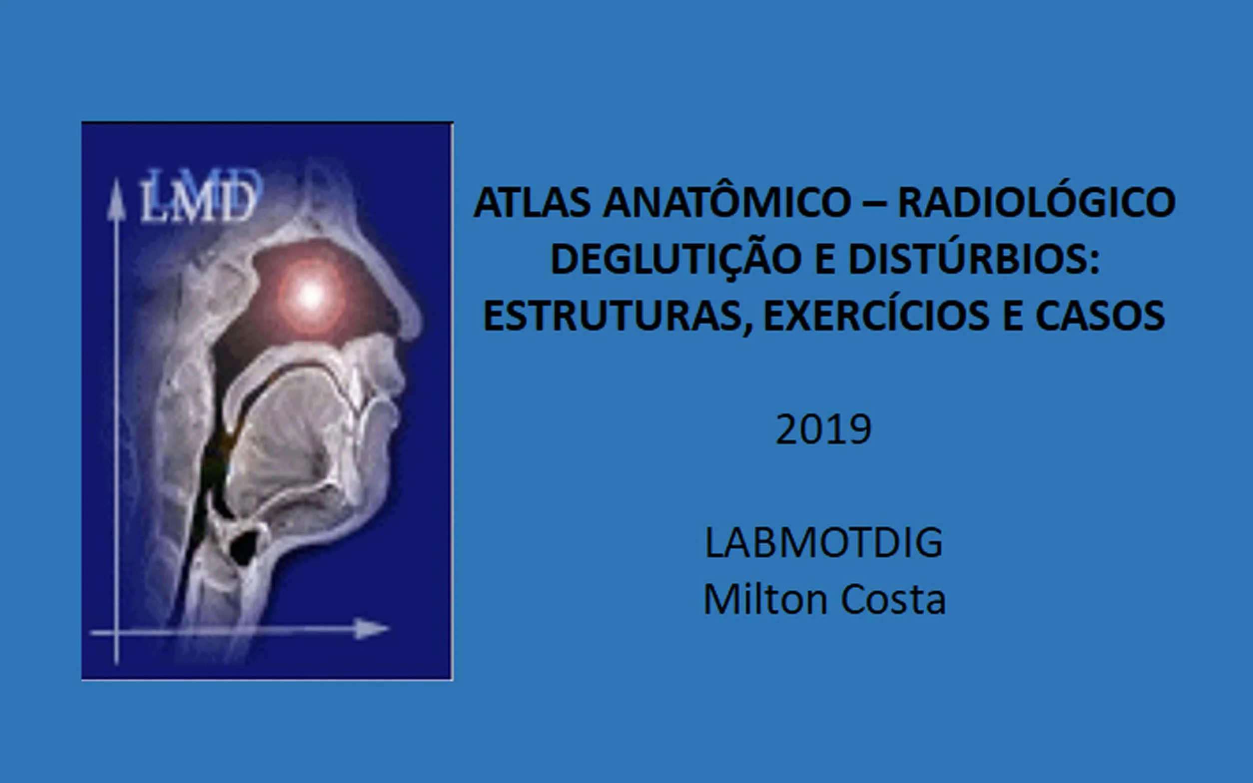 Atlas anatômico-radiológico deglutição e distúrbios: estruturas, exercícios e casos (Portuguese Edition)