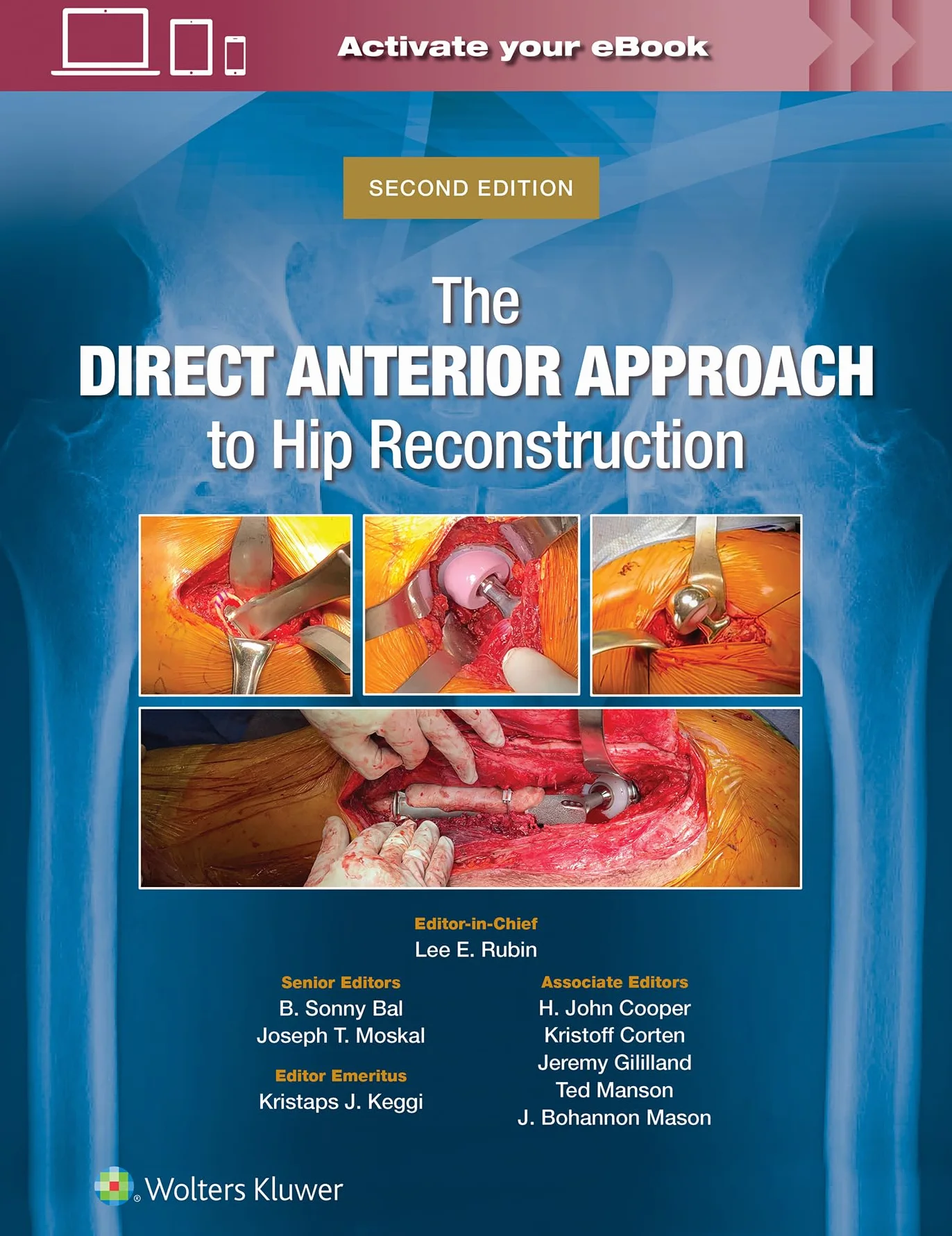 The Direct Anterior Approach to Hip Reconstruction