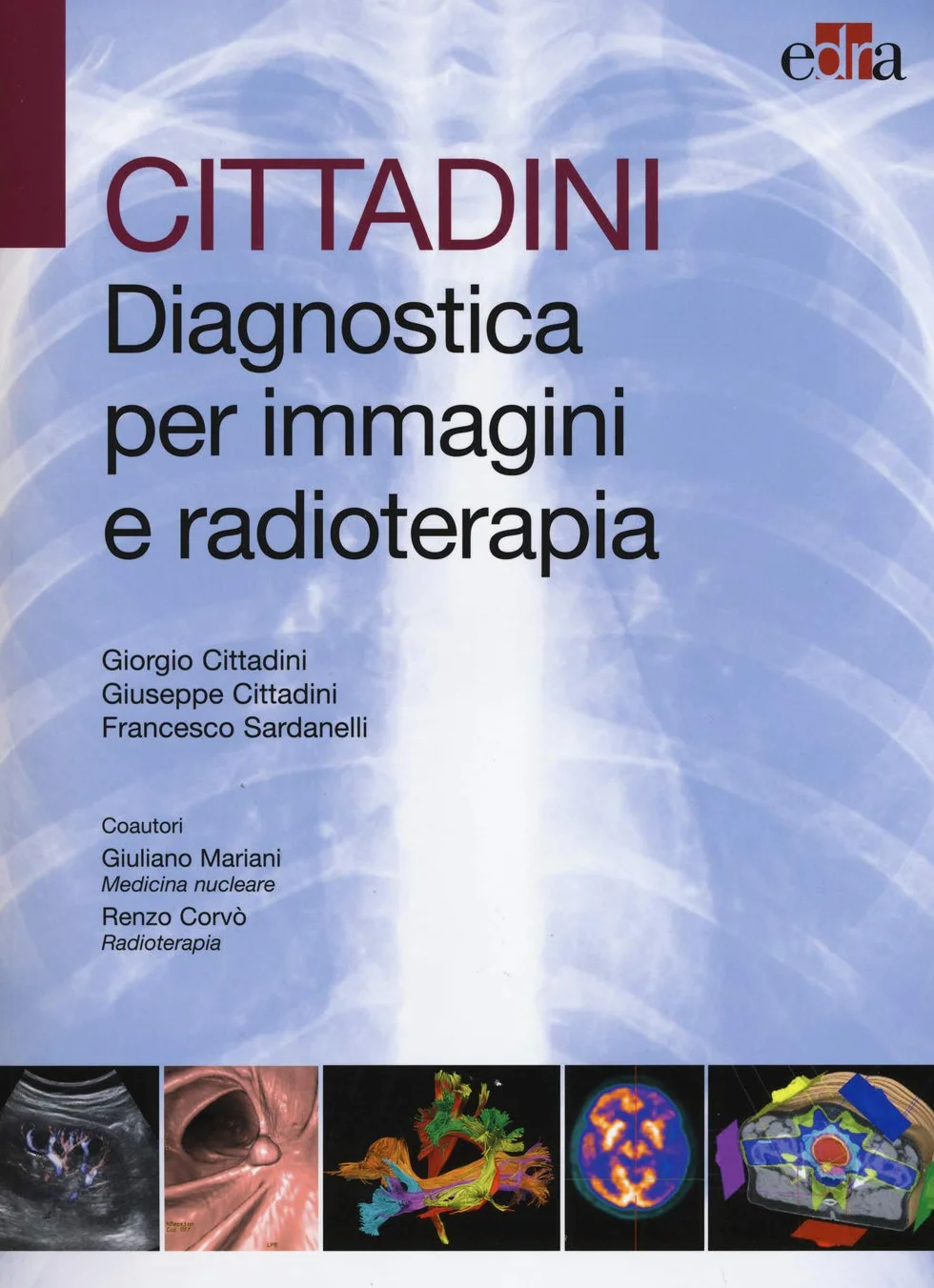 Cittadini. Diagnostica per immagini e radioterapia. Ediz. illustrata